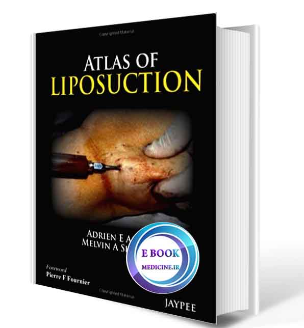 دانلود کتاب Atlas of Liposuction ( ORIGINAL PDF)